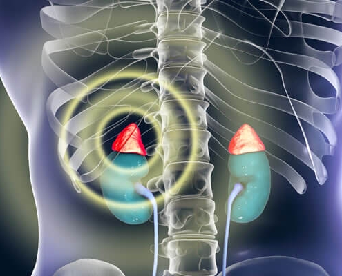 Adrenal & gonadal disorders