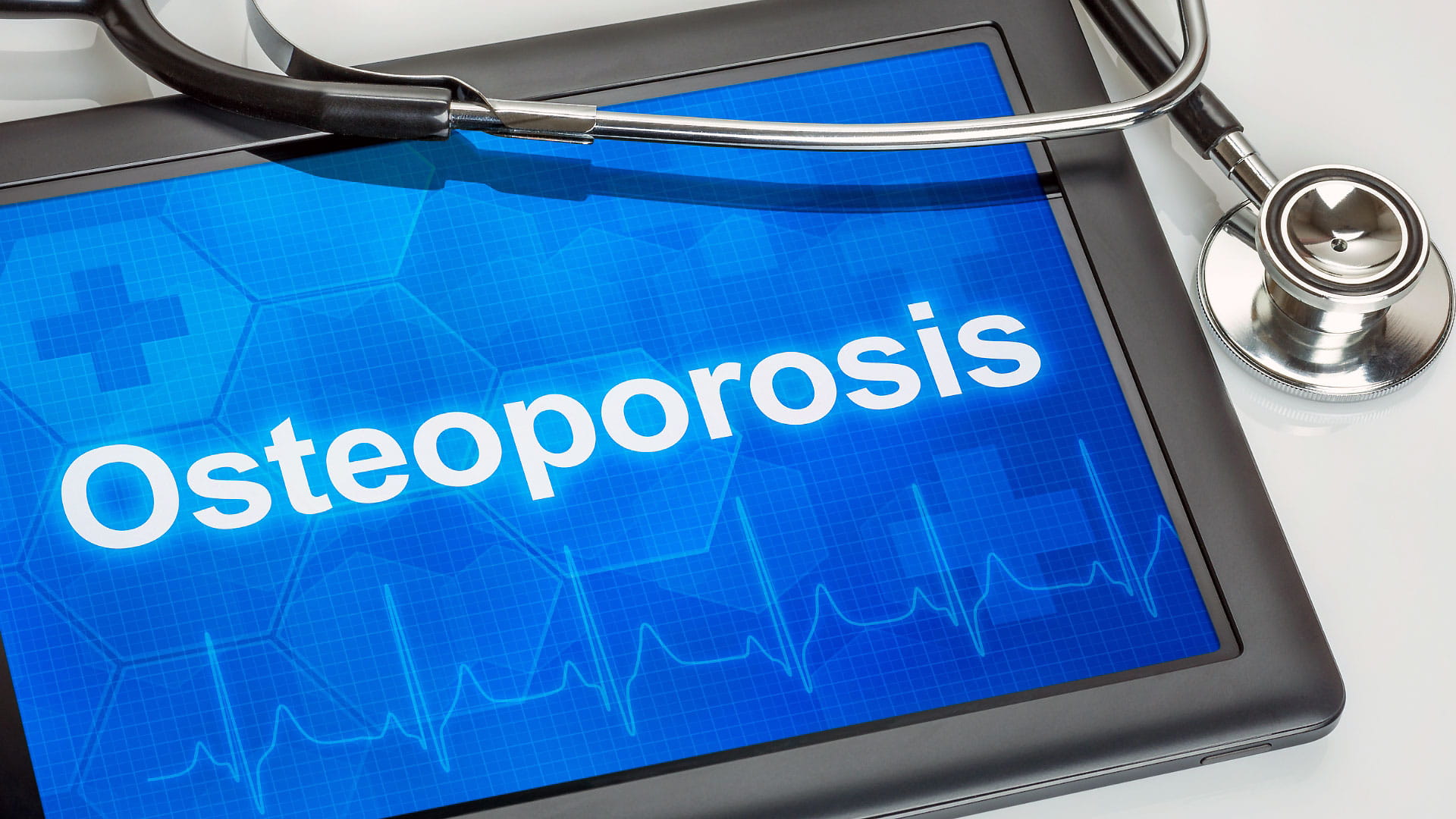 Osteoporosis